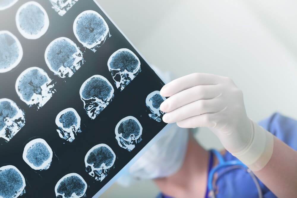A doctor reviewing an X-Ray scan of a patients brain to see if there are any traumatic injuries prevalent.